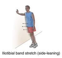 Iliotibial (IT) Band Syndrome exercises New York