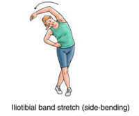 Iliotibial (IT) Band Syndrome exercises New York